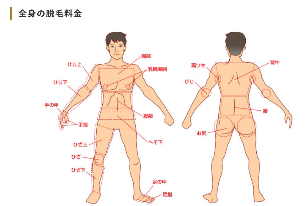 札幌中央クリニックの全身の脱毛箇所