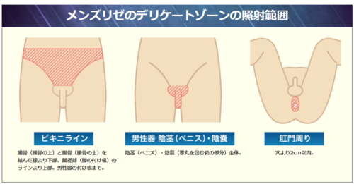 メンズリゼのデリケートの照射範囲 ビキニライン 男性器 陰茎(ペニス) 陰嚢 肛門周り