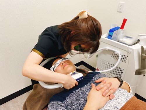 ゴリラクリニック札幌院の看護師が男性のヒゲに照射する様子