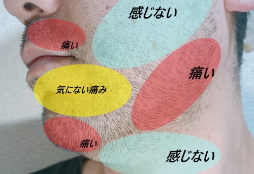 男性のヒゲの痛い部分と痛くない部分の色分け